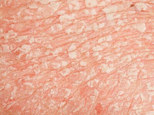 Почему шелушится кожа