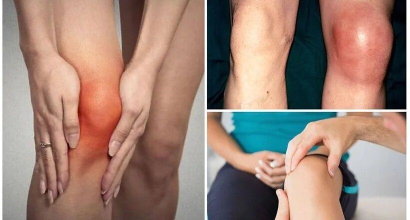 Что делать если болят колени