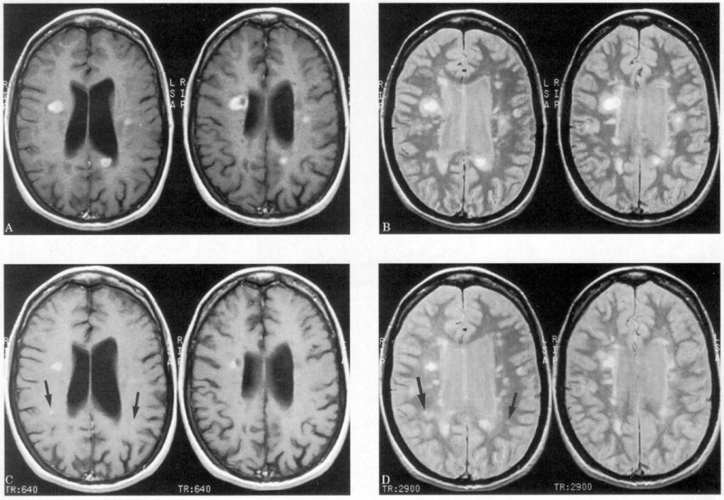 текст 1 гол боль ф2.jpg