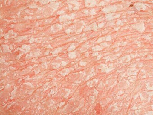 Почему шелушится кожа